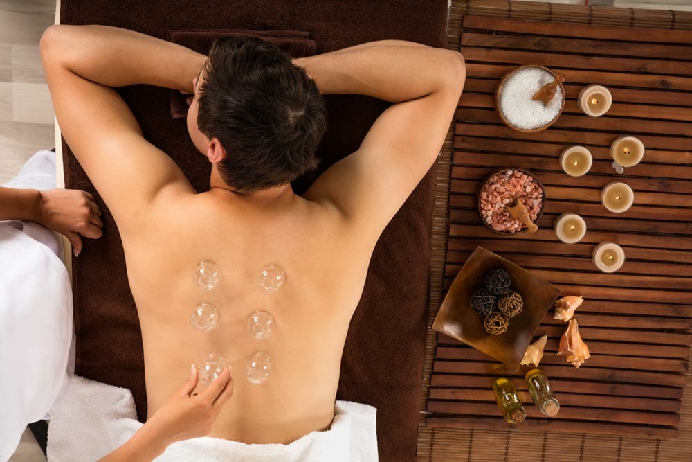 Cupping Therapy - Iris Healing - Luxury Addiction Treatment