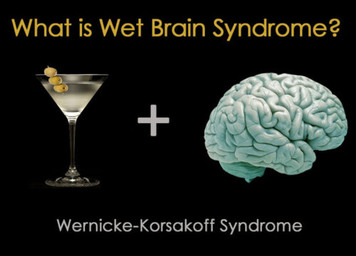 What is Wet Brain Syndrome? [Wernicke-Korsakoff Syndrome]